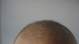 Miracle Grow
