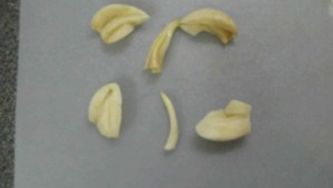 Love garlic, but hate the smell?