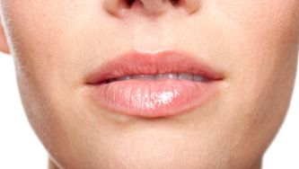 Cold sores
