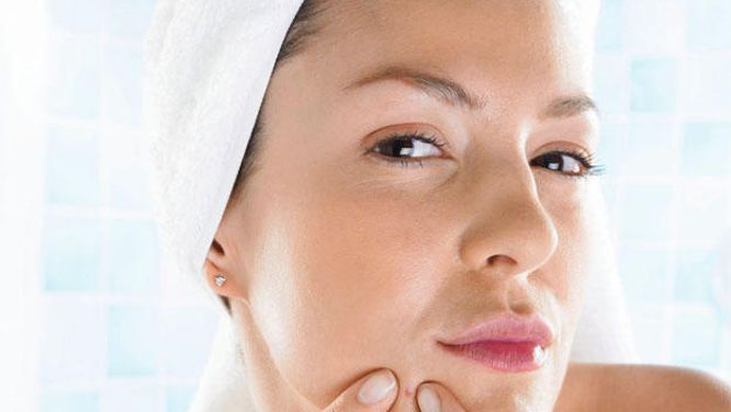 How to treat adult acne