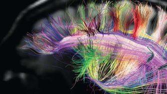 Researchers get a better picture of the brain