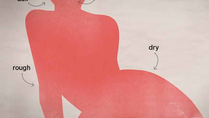 5 ugly winter skin problems — and how to solve them