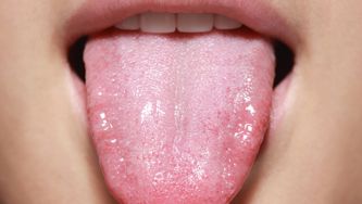 What your tongue can tell you about your health