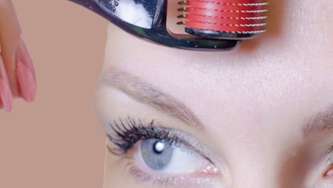 Microneedling for acne scars: Everything you need to know