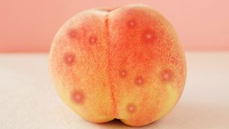 How Do I Get Rid Of Acne…On My Butt?
