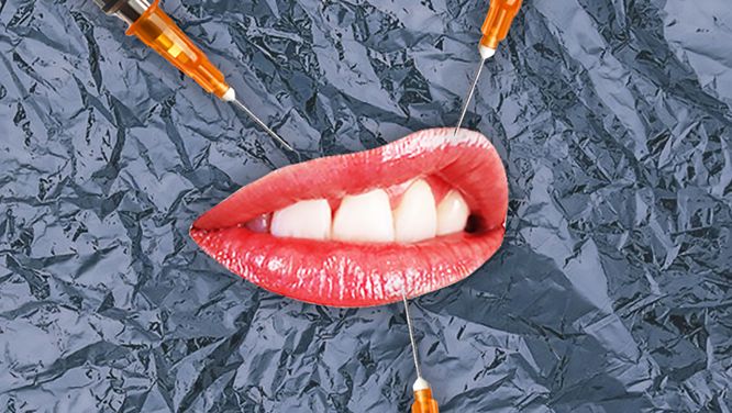 I Thought Botox Could Fix My Problems — But It Only Made Me More Upset