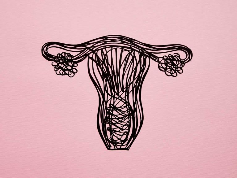 How do I know if I have Endometriosis-illustration of a utuerus by light and paper-illustration of a utuerus
