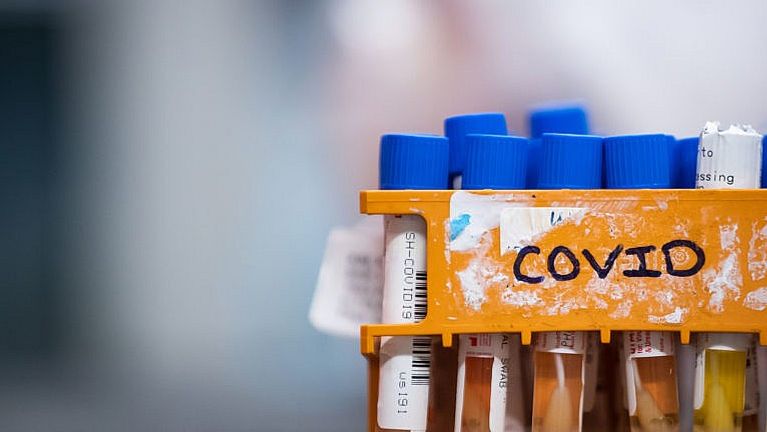 Specimens to be tested for COVID-19 in B.C. (Darryl Dyck/CP)