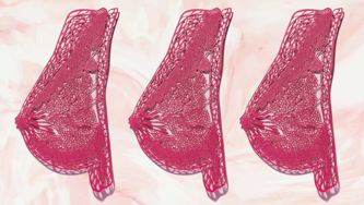 How To Navigate Breast Cancer Screening Guidelines