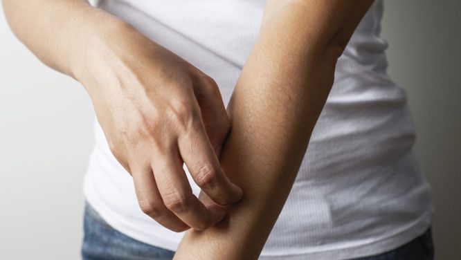 How To Treat Eczema, According To The Experts