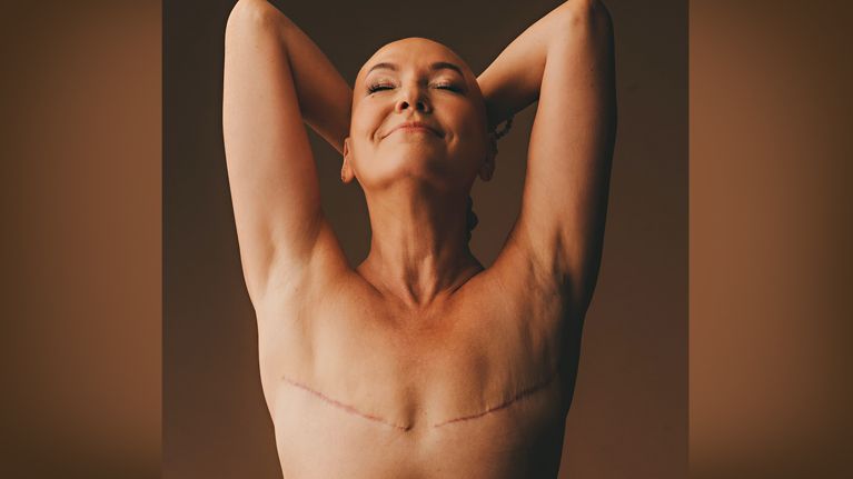 A woman modelling an aesthetic flat closure